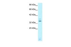 CHX10 Rabbit anti-Human, Polyclonal, Novus Biologicals 0.1 mL | Buy Online | Novus Biologicals | Fisher Scientific